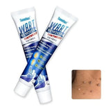 WART REMOVER - REMOVEDOR DE VERRUGAS 100% ORIGINAL